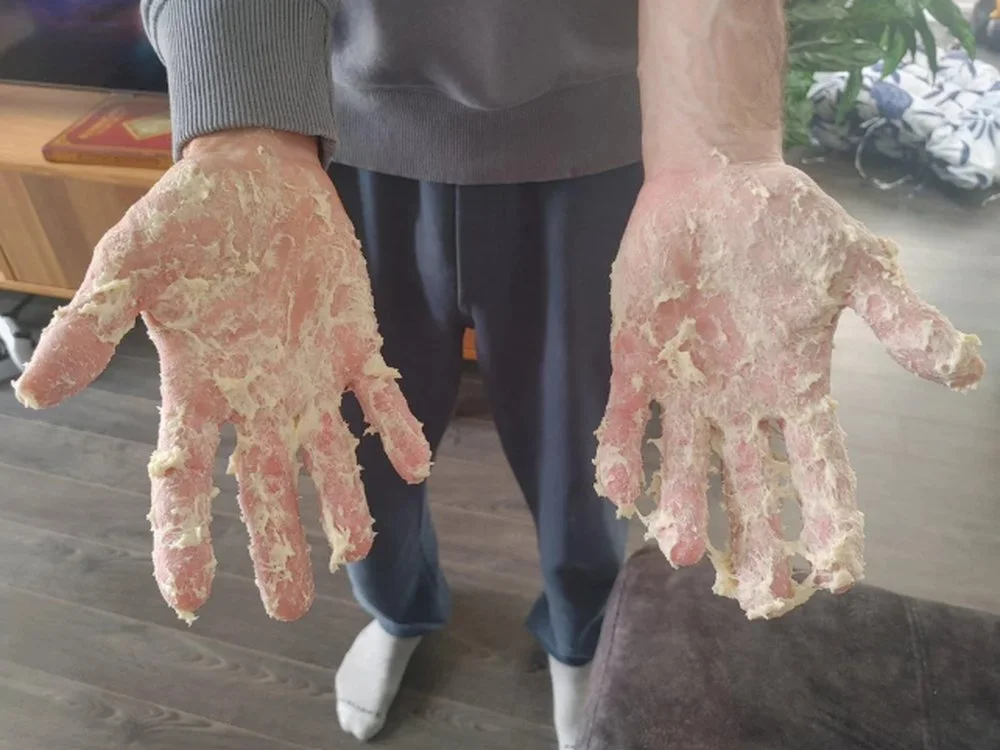 Your Dough Is Too Sticky to Handle
